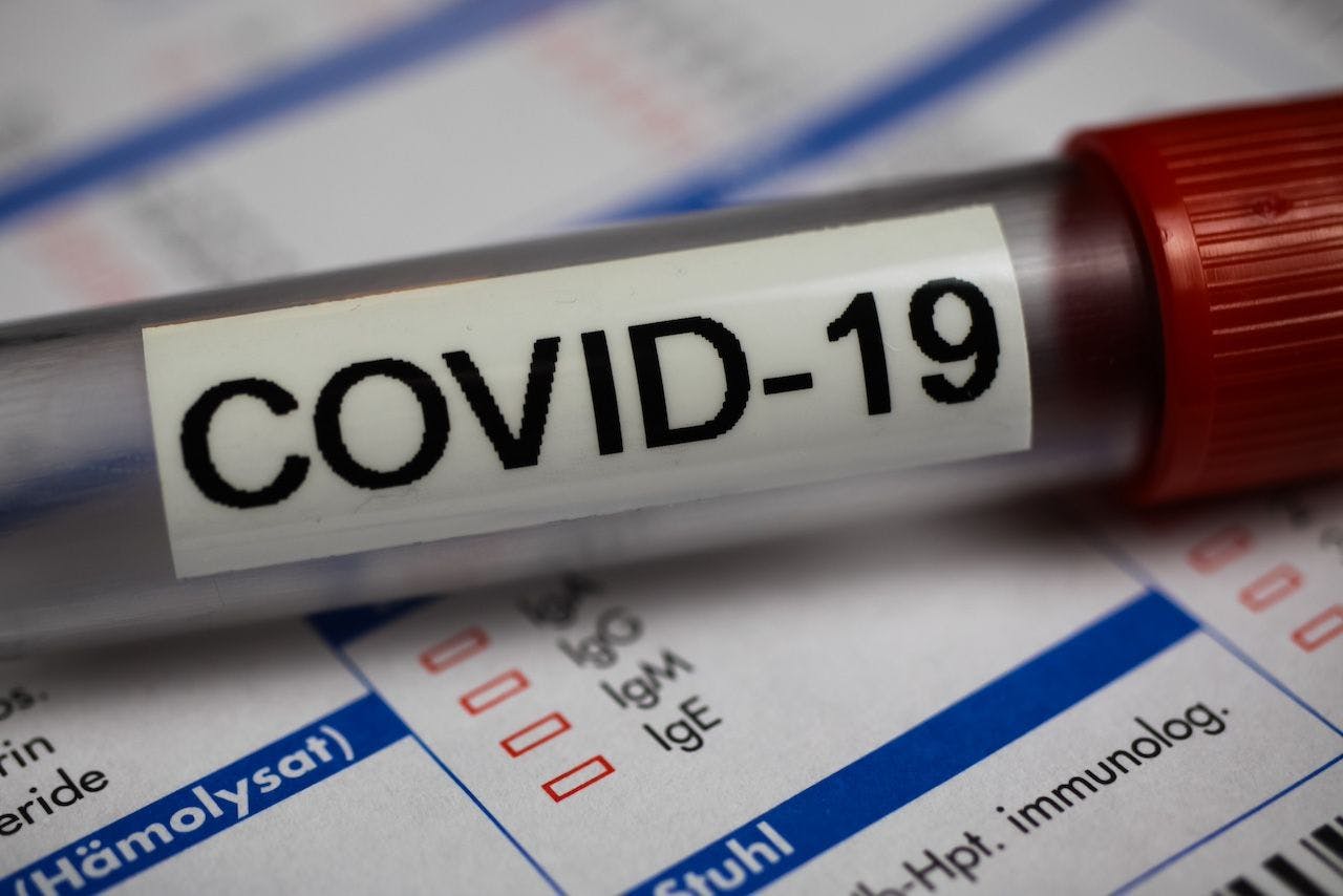 COVID-19 diagnostic test | Image credit: Ralf - stock.adobe.com