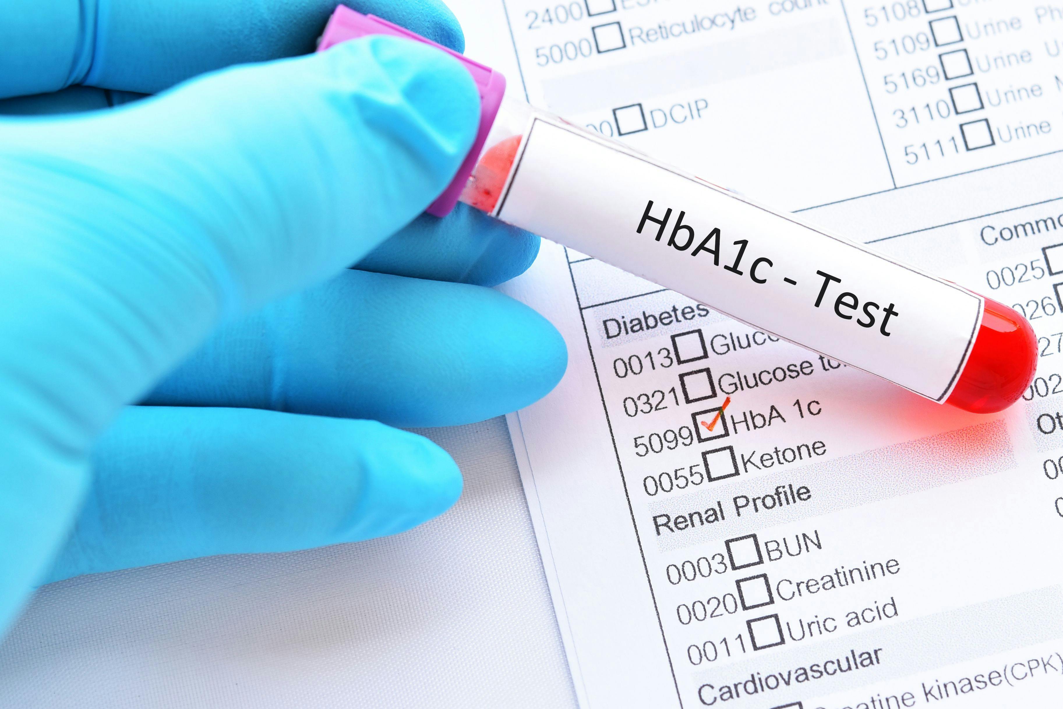 HbA1c test | Image credit: jarun011 – stock.adobe.com