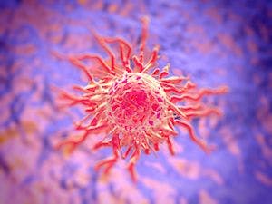 Review Looks at Role Lipocalin 2 Might Play in Spread of Breast Cancer