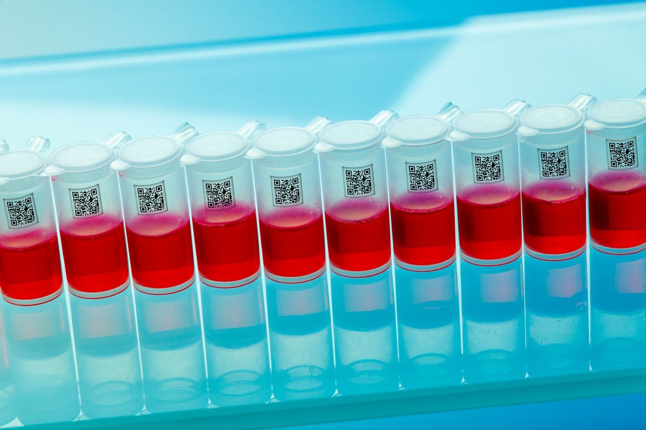 Blood in tubes for testing