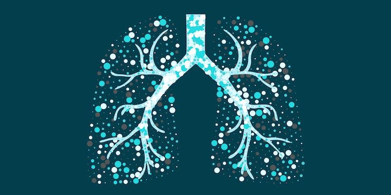 Patients With Asthma–COPD Overlap Have More Severe Disease, Study Finds