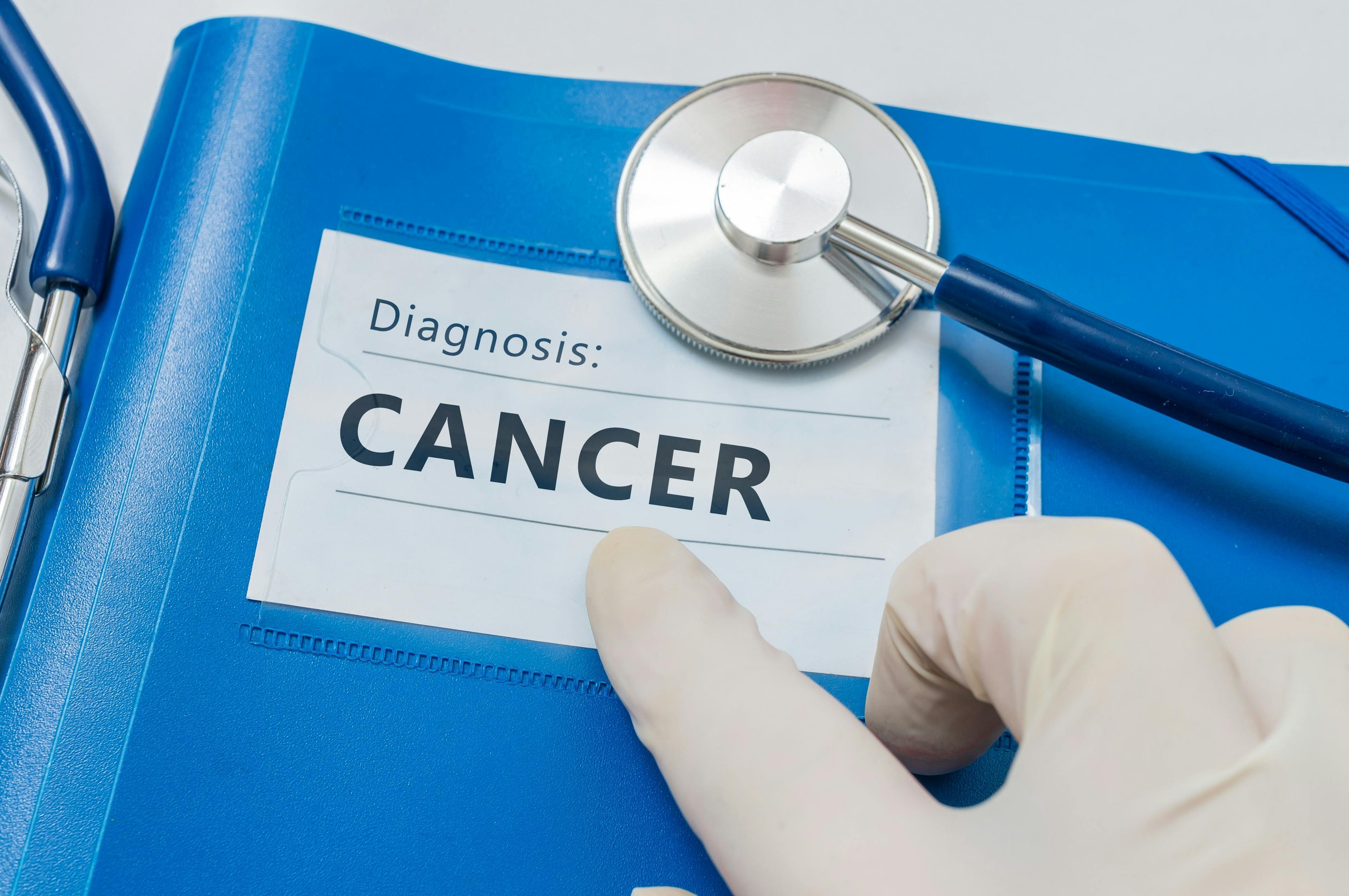 Blue folder with Cancer diagnosis | Image credit: vchalup - stock.adobe.com